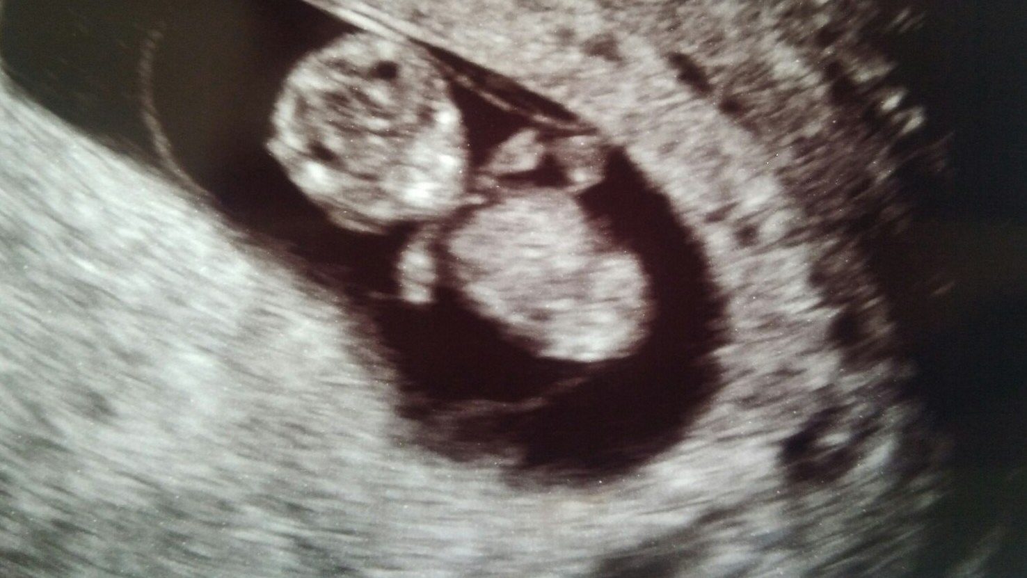 Thursday, August 22: Day 122 – Oh Baby!